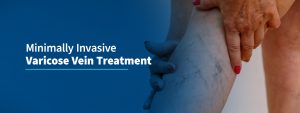 minimally invasive treatment