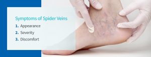 03-symptoms-of-spider-veins-1