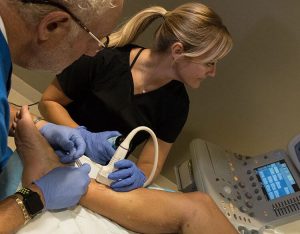 Varicose vein ultrasound