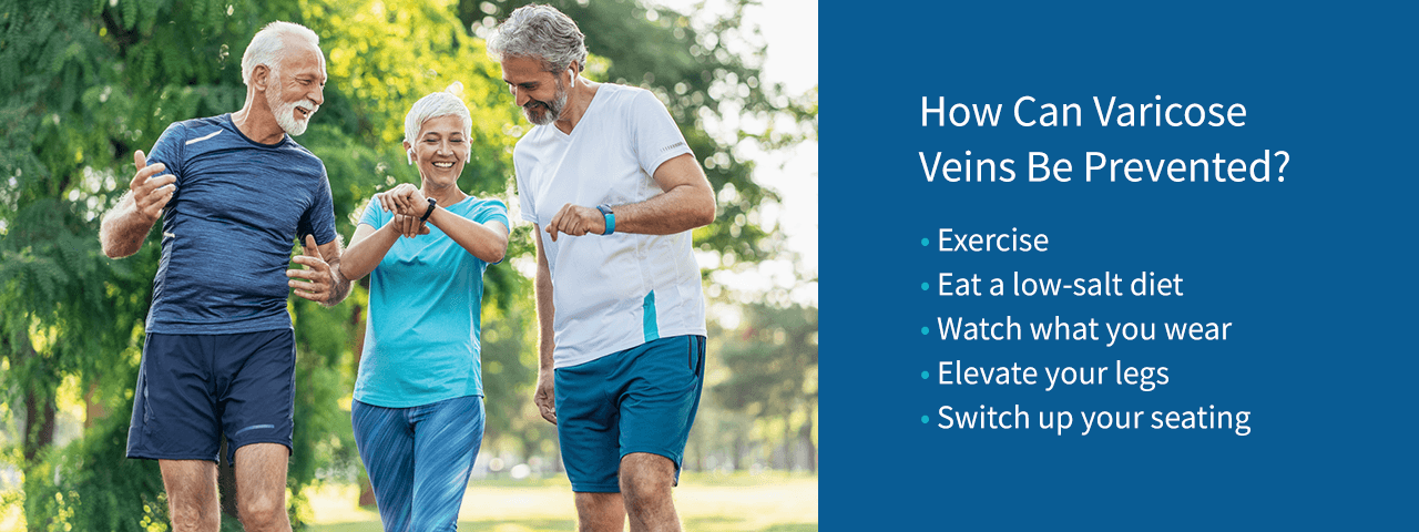 How varicose veins can be prevented